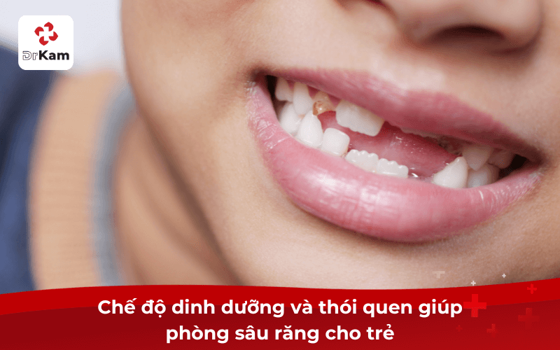 4 Tips phòng sâu răng cho trẻ em hiệu quả cha mẹ cần biết 4 Chế độ dinh dưỡng và thói quen giúp phòng sâu răng cho trẻ