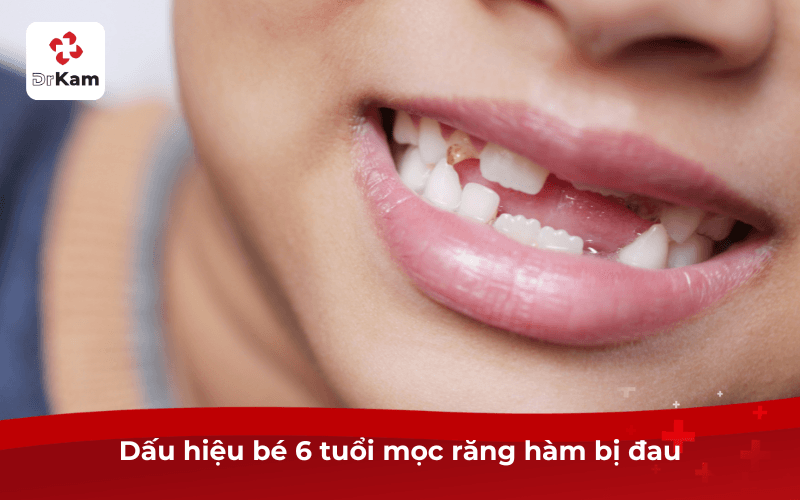 Dấu hiệu bé 6 tuổi mọc răng hàm bị đau