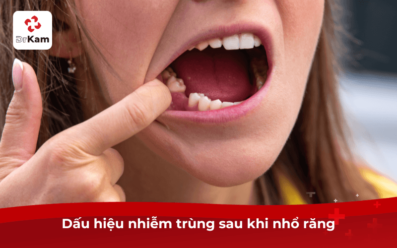 Dấu hiệu nhiễm trùng sau khi nhổ răng