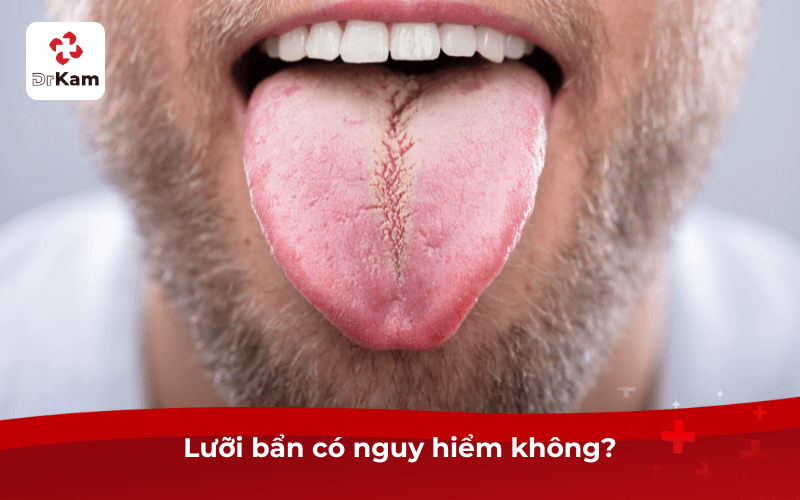 Lưỡi bẩn phải làm sao? Dấu hiệu, nguyên nhân và cách cạo lưỡi đúng cách 4 Lưỡi bẩn có nguy hiểm không?