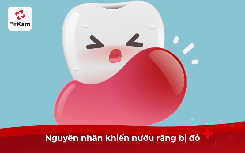Nguyên nhân khiến nướu răng bị đỏ