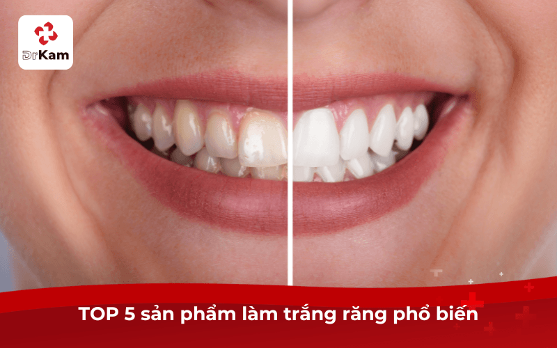 TOP 5 sản phẩm làm trắng răng tốt nhất 2026 nên dùng 4 TOP 5 sản phẩm làm trắng răng phổ biến