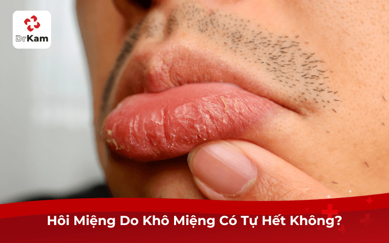Hôi Miệng Do Khô Miệng Có Tự Hết Không?