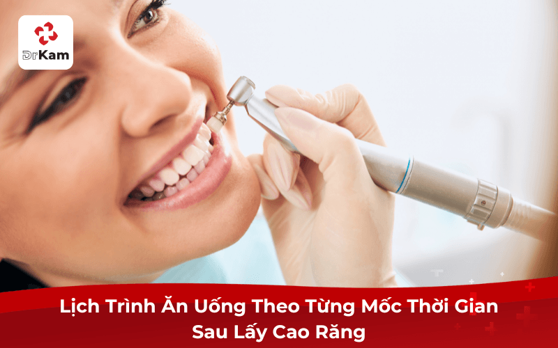 Sau khi lấy cao răng bao lâu thì được ăn?