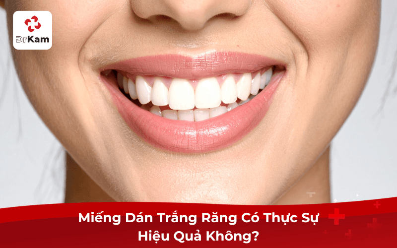 Thực hư miếng dán trắng răng hiệu quả? 3 phương pháp trắng răng an toàn hiện nay 4 Miếng Dán Trắng Răng Có Thực Sự Hiệu Quả Không?