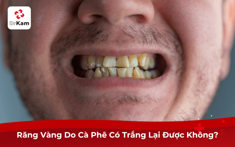 Răng Vàng Do Cà Phê Có Trắng Lại Được Không?
