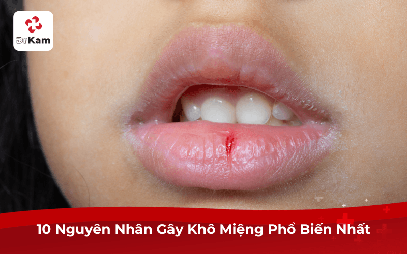 Khô Miệng: Nguyên Nhân, Dấu Hiệu và Cách Chữa Hiệu Quả Tại Nhà 4 10 Nguyên Nhân Gây Khô Miệng Phổ Biến Nhất