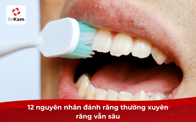 12 nguyên nhân đánh răng thường xuyên răng vẫn sâu