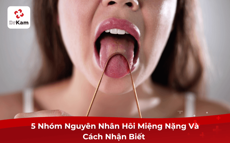 5 Nhóm Nguyên Nhân Hôi Miệng Nặng Và Cách Nhận Biết 