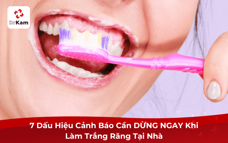 Làm trắng răng tại nhà có an toàn không?