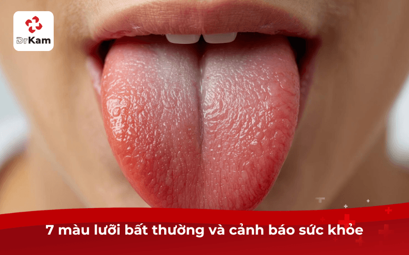 Làm sao để lưỡi hồng hào? 8 cách giúp lưỡi sạch và khỏe tại nhà 5 7 màu lưỡi bất thường và cảnh báo sức khỏe