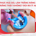 [Thực hư] Gel Làm Trắng Răng Có Trắng Thật Không? Rủi Ro Ít Ai Biết