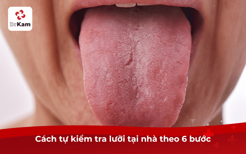 Ung thư lưỡi: Dấu hiệu, nguyên nhân, điều trị và cách tự kiểm tra 6 Cách tự kiểm tra lưỡi tại nhà theo 6 bước