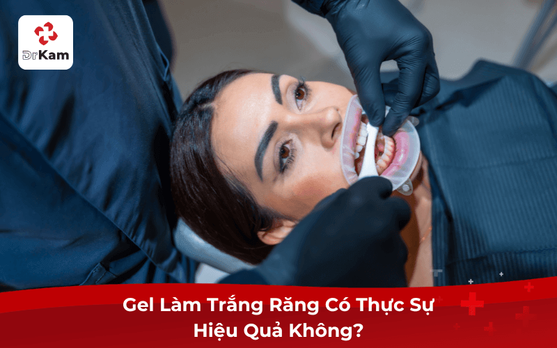 Gel Làm Trắng Răng Có Thực Sự Hiệu Quả Không?
