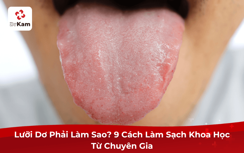Lưỡi Dơ Phải Làm Sao? 9 Cách Làm Sạch Lưỡi Khoa Học 2026 4 Lưỡi Dơ Phải Làm Sao? 9 Cách Làm Sạch Khoa Học Từ Chuyên Gia