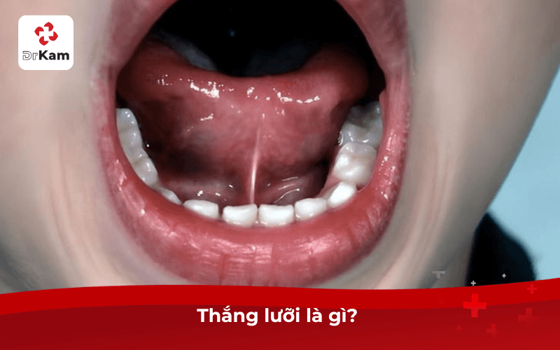 Thắng lưỡi là gì? 
