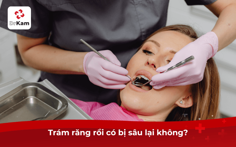 Trám răng rồi có bị sâu lại không?