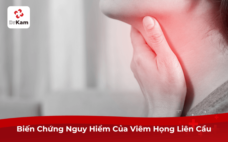 Biến Chứng Nguy Hiểm Của Viêm Họng Liên Cầu