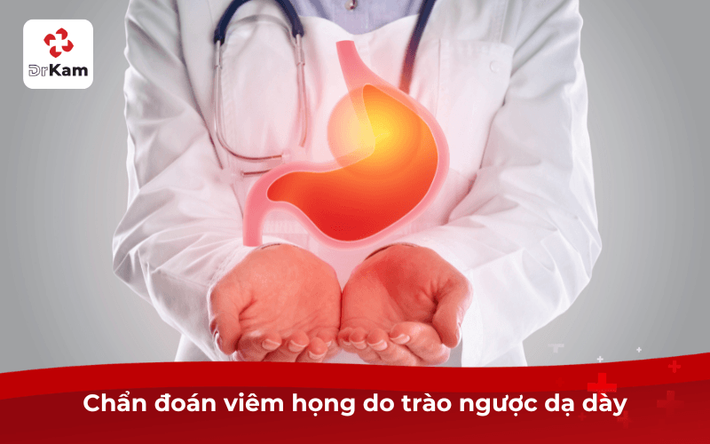 Chẩn đoán viêm họng do trào ngược dạ dày