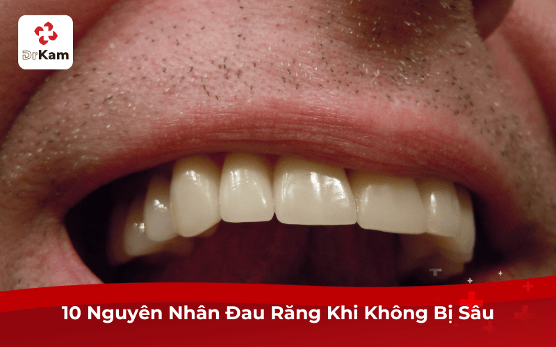 10 Nguyên Nhân Đau Răng Khi Không Bị Sâu