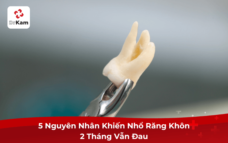 Nhổ Răng Khôn 2 Tháng Vẫn Đau: Nguyên Nhân và Cần Làm Gì Ngay? 4 5 Nguyên Nhân Khiến Nhổ Răng Khôn 2 Tháng Vẫn Đau