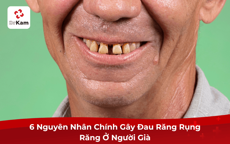 6 Nguyên Nhân Chính Gây Đau Răng Rụng Ở Người Già