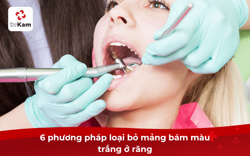 6 phương pháp loại bỏ mảng bám màu trắng ở răng
