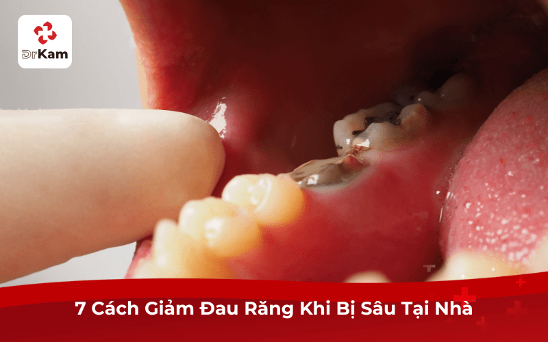 7 Cách Giảm Đau Răng Khi Bị Sâu Tại Nhà