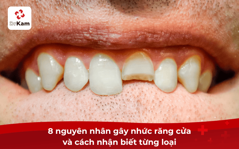 8 nguyên nhân gây nhức răng cửa và cách nhận biết từng loại