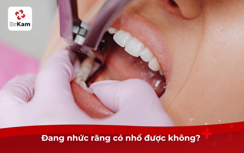 Đang nhức răng có nhổ được không?