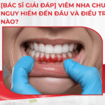 [Bác sĩ giải đáp] Viêm nha chu nặng nguy hiểm đến đâu và điều trị thế nào?
