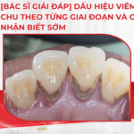 [Bác sĩ giải đáp] Dấu hiệu viêm nha chu theo từng giai đoạn và cách nhận biết sớm