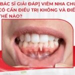 [Bác sĩ giải đáp] Viêm nha chu nhẹ có cần điều trị không và điều trị thế nào?