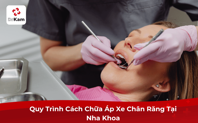 Quy Trình Cách Chữa Áp Xe Chân Răng Tại Nha Khoa