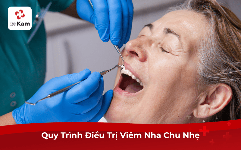 Quy Trình Điều Trị Viêm Nha Chu Nhẹ