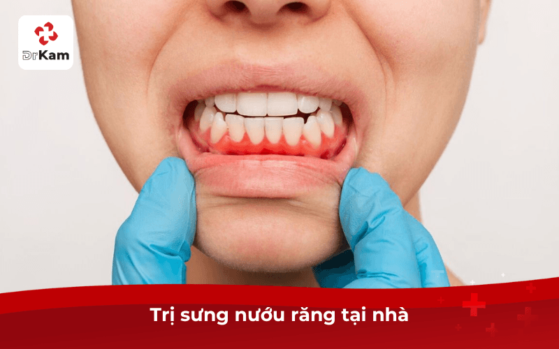 Trị Sưng Nướu Răng Tại Nhà