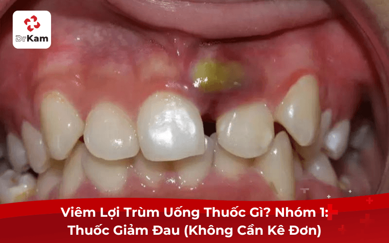 Viêm Lợi Trùm Uống Thuốc Gì? Nhóm 1: Thuốc Giảm Đau