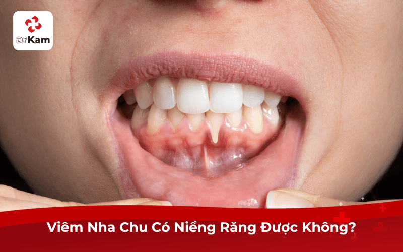 Viêm Nha Chu Có Niềng Răng Được Không?