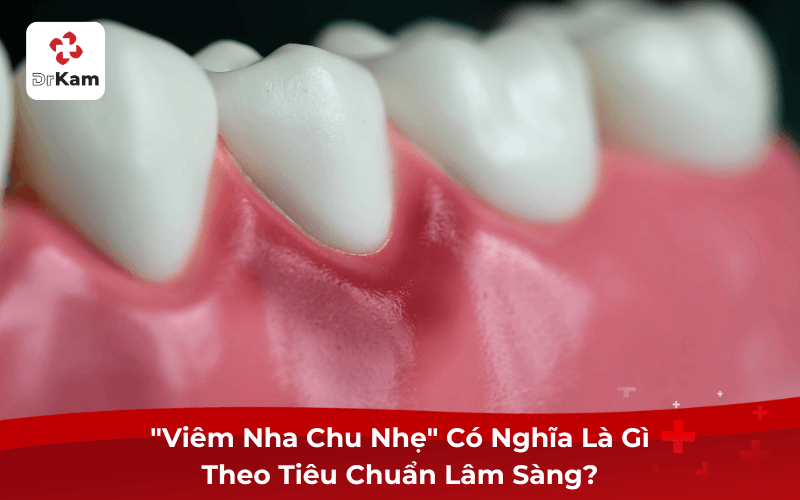"Viêm Nha Chu Nhẹ" Có Nghĩa Là Gì Theo Tiêu Chuẩn Lâm Sàng?