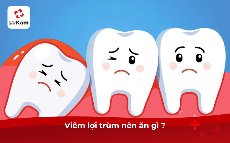 Viêm Lợi Trùm Nên Ăn Gì ?