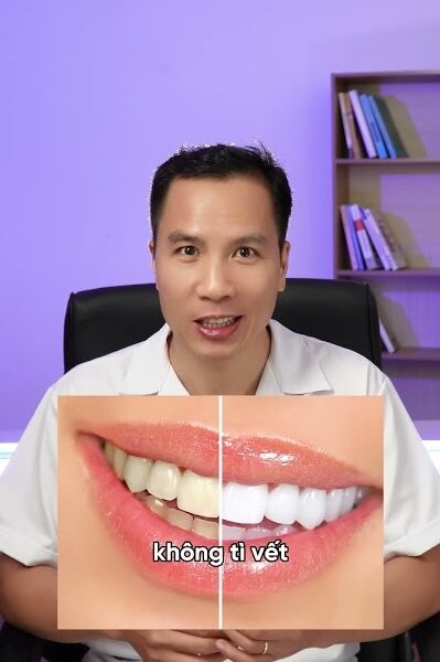 Bí kíp nụ cười sáng như sao
