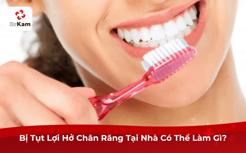 Bị Tụt Lợi Hở Chân Răng Tại Nhà Có Thể Làm Gì?