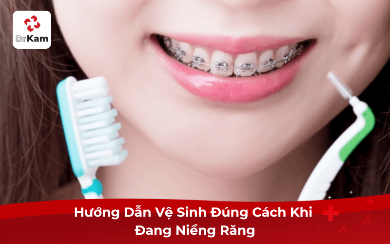 Hướng Dẫn Vệ Sinh Đúng Cách Khi Đang Niềng Răng