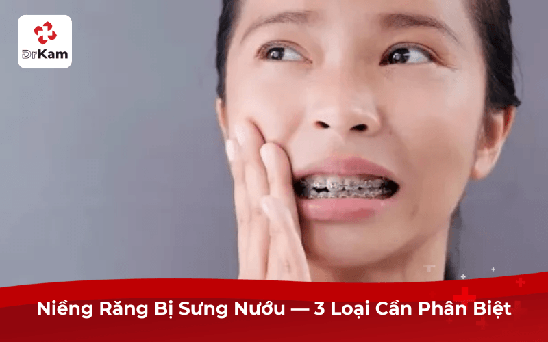 Niềng Răng Bị Sưng Nướu — 3 Loại Cần Phân Biệt