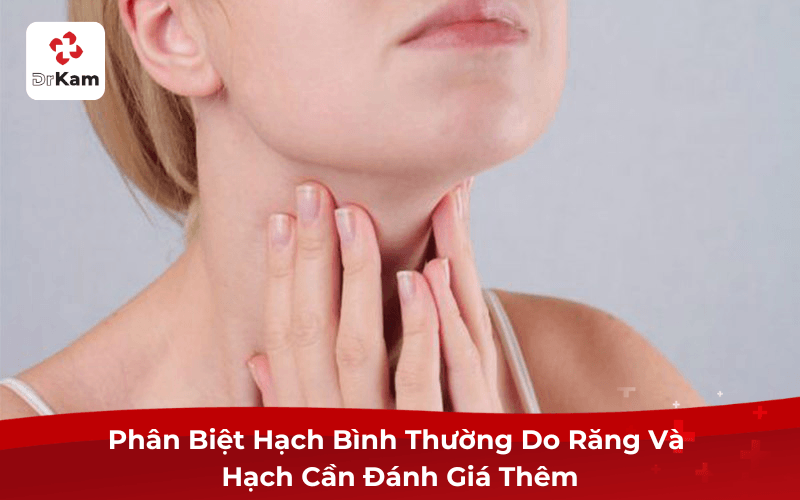 Phân biệt sưng nướu răng và nổi hạch