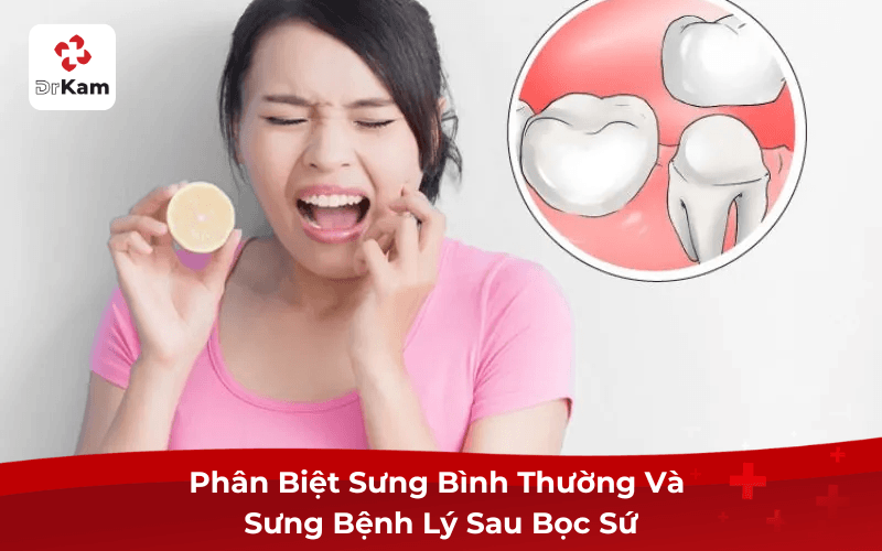 Phân Biệt Sưng Bình Thường Và Sưng Bệnh Lý Sau Bọc Sứ